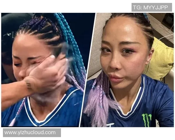 扇耳光大赛倒地的中国选手发布病历！称看东西有重影需求手术